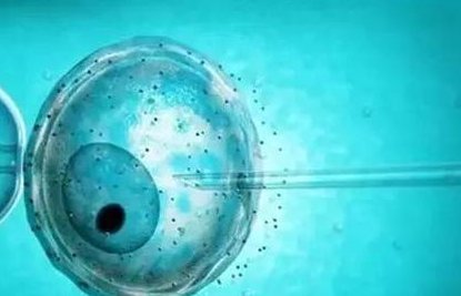 宁安市生孩子做染色体检查有必要吗，筛查一次大概需要多少钱？